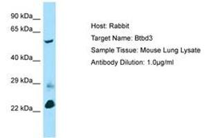 BTBD3 anticorps  (AA 367-416)