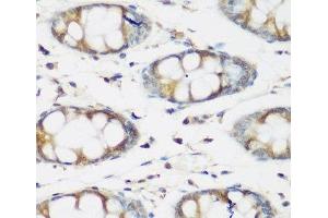 Immunohistochemistry of paraffin-embedded Human colon using BMP2 Polyclonal Antibody at dilution of 1:200 (40x lens). (BMP2 anticorps)