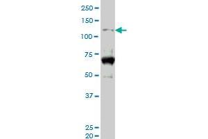 HIPK2 monoclonal antibody (M06), clone 4E3. (HIPK2 anticorps  (AA 961-1065))