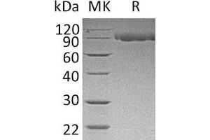 Western Blotting (WB) image for Serpin Peptidase Inhibitor, Clade G (C1 Inhibitor), Member 1 (SERPING1) protein (His tag) (ABIN7320645)
