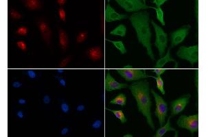ABIN6264533 and ABIN6276573 staining HUVEC cells by IF/ICC. (PYCARD anticorps  (N-Term))