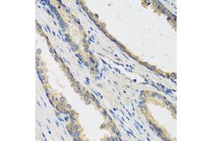 Immunohistochemistry of paraffin-embedded human prostate using RAD51C antibody (ABIN5974185) at dilution of 1/100 (40x lens). (RAD51C anticorps)