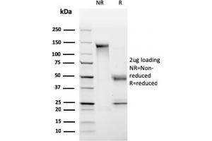 SDS-PAGE Analysis Purified HLA-Pan Mouse Monoclonal Antibody (CR3/43). (MHC Class II HLA-DP/DQ/DR anticorps)