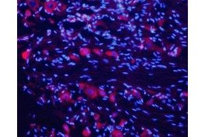 Expression of nAChRα7 in rat DRGImmunohistochemical staining of rat dorsal root ganglion (DRG) frozen sections using Anti-Nicotinic Acetylcholine Receptor α7 (CHRNA7) (extracellular) Antibody (ABIN7043067, ABIN7044631 and ABIN7044632), (1:200). (Cholinergic Receptor, Nicotinic, alpha 7 (Neuronal) (CHRNA7) Peptide)