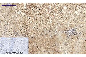 Immunohistochemical analysis of paraffin-embedded human liver tissue.