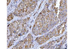 IHC analysis of Beclin 1 using anti-Beclin 1 antibody (ABIN7599303).