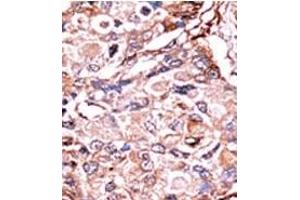 Image no. 2 for anti-SMAD, Mothers Against DPP Homolog 3 (SMAD3) (pSer213) antibody (ABIN358226) (SMAD3 anticorps  (pSer213))