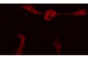 ABIN6277217 staining HepG2 by IF/ICC. (BIK anticorps  (N-Term))