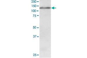 USP11 polyclonal antibody  staining (1 ug/mL) of Jurkat lysate (RIPA buffer, 30 ug total protein per lane). (USP11 anticorps)