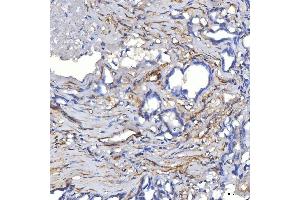 IHC analysis of TP53I13 using anti-TP53I13 antibody (ABIN7601220). (TP53I13 anticorps  (AA 30-365))