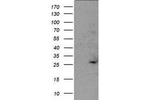 Western Blotting (WB) image for anti-Suppressor of Cytokine Signaling 3 (SOCS3) antibody (ABIN1501060) (SOCS3 anticorps)