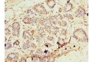 Immunohistochemistry of paraffin-embedded human breast cancer using ABIN7164746 at dilution of 1:100
