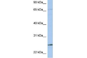 WB Suggested Anti-KLK6 Antibody Titration:  0. (Kallikrein 6 anticorps  (N-Term))