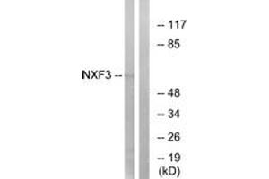 Western blot analysis of extracts from MCF-7 cells, using NXF3 Antibody. (NXF3 anticorps  (AA 72-121))