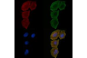 ABIN6258471 and ABIN6275673 staining Hela cells(30 min of UV treatment) by IF/ICC.