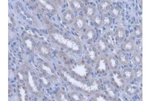 IHC-P analysis of Rat Kidney Tissue, with DAB staining. (PLTP anticorps  (AA 337-479))