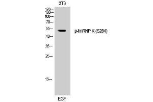 Western Blotting (WB) image for anti-Heterogeneous Nuclear Ribonucleoprotein K (HNRNPK) (pSer284) antibody (ABIN3182264)