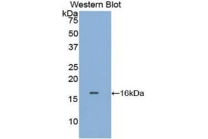 Western blot analysis of the recombinant protein. (TPSAB1 anticorps  (AA 29-148))