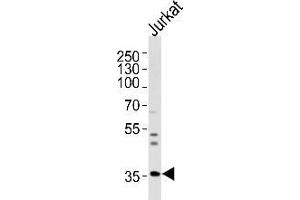 Western blot analysis of lysate from Jurkat cell line, using Glycine receptor beta Antibody (N-term) Cat. (GLRB anticorps  (N-Term))
