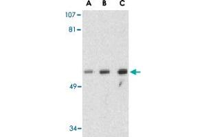 Western blot analysis of GOPC in PC-3 cell lysate with GOPC polyclonal antibody  at (A) 1, (B) 2 and (C) 4 ug/mL . (GOPC anticorps  (Internal Region))