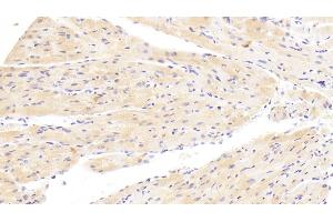 Detection of WISP1 in Mouse Heart Tissue using Polyclonal Antibody to WNT1 Inducible Signaling Pathway Protein 1 (WISP1)