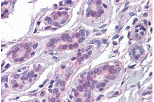 Human Breast: Formalin-Fixed, Paraffin-Embedded (FFPE)