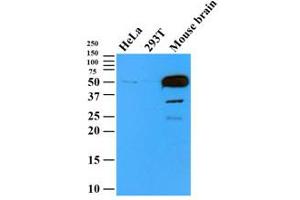 Western Blotting (WB) image for anti-Tubulin, beta 2B (TUBB2B) antibody (ABIN567612) (TUBB2B anticorps)