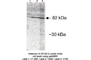 Image no. 1 for anti-Scavenger Receptor Class B, Member 2 (SCARB2) antibody (ABIN363400) (SCARB2 anticorps)
