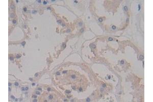 Detection of SDC1 in Human Kidney Tissue using Polyclonal Antibody to Syndecan 1 (SDC1)