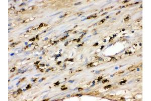 IHC(P): Human Appendicitis Tissue