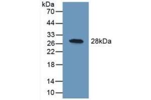 Detection of Recombinant UCHL1, Human using Polyclonal Antibody to Ubiquitin Carboxyl Terminal Hydrolase L1 (UCHL1) (UCHL1 anticorps  (AA 2-223))