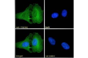 ABIN570771 Immunofluorescence analysis of paraformaldehyde fixed U2OS cells, permeabilized with 0. (COL4a6 anticorps  (Internal Region))