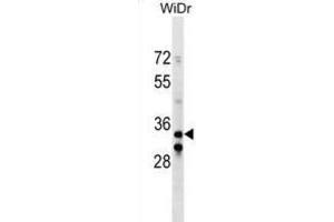 Western Blotting (WB) image for anti-Integrin beta 1 Binding Protein (Melusin) 2 (ITGB1BP2) antibody (ABIN2999936) (ITGB1BP2 anticorps)
