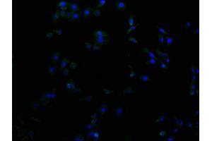 Immunofluorescence staining of A549 cells with ABIN7156172 at 1:100, counter-stained with DAPI. (RHBDF2 anticorps  (AA 1-200))