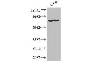 Western Blot Positive WB detected in: Mouse lung tissue All lanes: SLC28A3 antibody at 3 μg/mL Secondary Goat polyclonal to rabbit IgG at 1/50000 dilution Predicted band size: 77, 70 kDa Observed band size: 77 kDa (SLC28A3 anticorps  (AA 1-102))