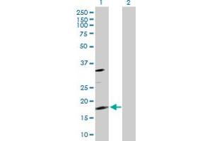 Western Blot analysis of TSC22D1 expression in transfected 293T cell line by TSC22D1 MaxPab polyclonal antibody. (TSC22D1 anticorps  (AA 1-144))