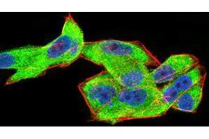 Immunofluorescence analysis of Hela cells using CFHR5 mouse mAb (green).