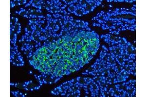 IF analysis of SYP using anti-SYP antibody (ABIN3042768). (Synaptophysin anticorps  (N-Term))