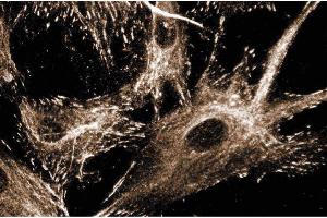Immunofluoresence staining of human fibroblasts. (Paxillin anticorps  (AA 1-557))