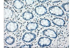 Immunohistochemical staining of paraffin-embedded pancreas tissue using anti-CHEK2mouse monoclonal antibody. (CHEK2 anticorps)