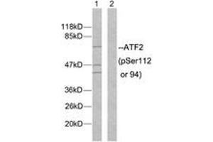 Western blot analysis of extracts from MDA-MB-435 cells, using ATF2 (Phospho-Ser112 or 94) Antibody. (ATF2 anticorps  (pSer112))