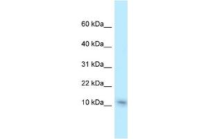 WB Suggested Anti-Nme1 Antibody Titration: 1. (NME1 anticorps  (C-Term))