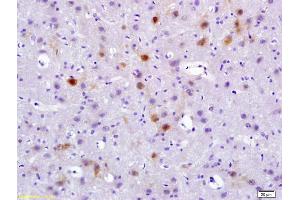 Formalin-fixed and paraffin embedded rat brain labeled with Rabbit Anti phospho-Pyk2/PTK2B(Tyr402) Polyclonal Antibody, Unconjugated (ABIN745763) at 1:200 followed by conjugation to the secondary antibody and DAB staining (PTK2B anticorps  (pTyr402))