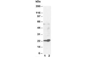 Western blot testing of GST pi antibody and Lane 1:  MCF-7 (Glutathione S Transferases pi anticorps)
