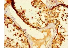 Immunohistochemistry of paraffin-embedded human testis tissue using ABIN7173524 at dilution of 1:100 (DUS3L anticorps  (AA 221-409))
