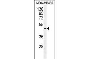 Western blot analysis in MDA-MB435 cell line lysates (35ug/lane). (GDF5 anticorps  (C-Term))