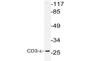 Western blot (WB) analysis of CD3-epsilon antibody in extracts from K562 cells. (CD3 anticorps)