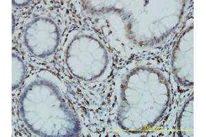 Image no. 2 for anti-General Transcription Factor IIIC, Polypeptide 2, beta 110kDa (GTF3C2) (AA 1-912) antibody (ABIN598719) (GTF3C2 anticorps  (AA 1-912))