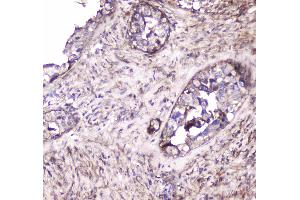 IHC analysis of S100A10 using anti-S100A10 antibody .