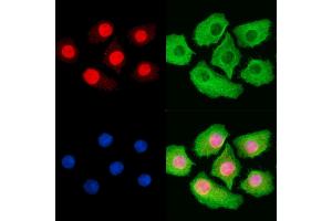 Phospho-MCM2 (Ser41) Antibody staining Hela cells by IF/ICC. (MCM2 anticorps  (pSer41))
